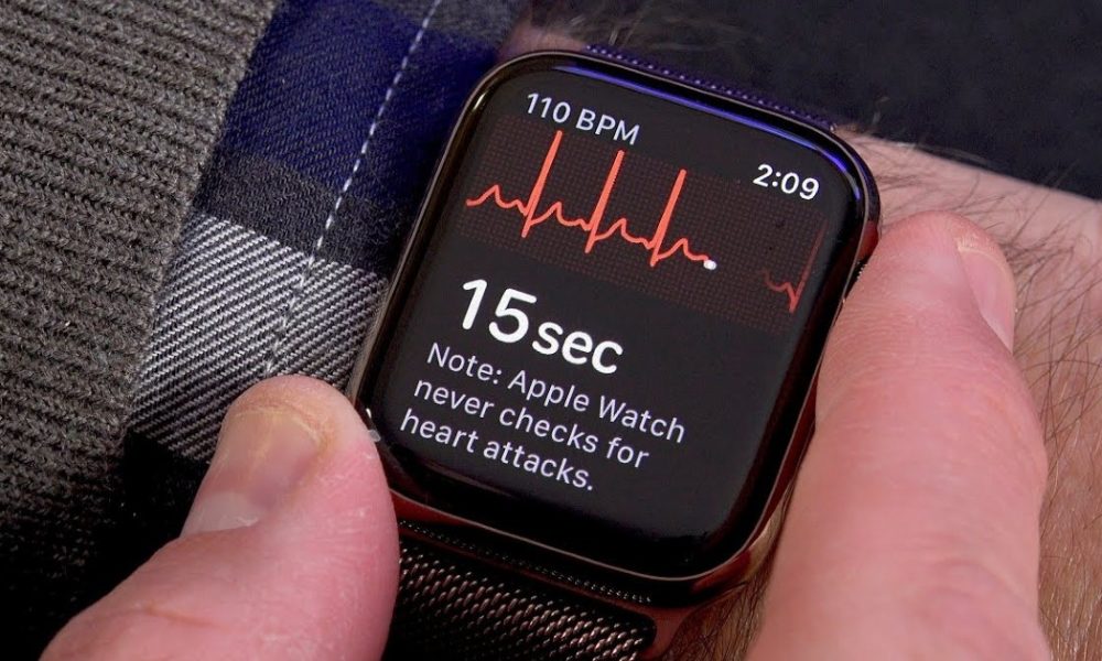 Apple Watch ECG